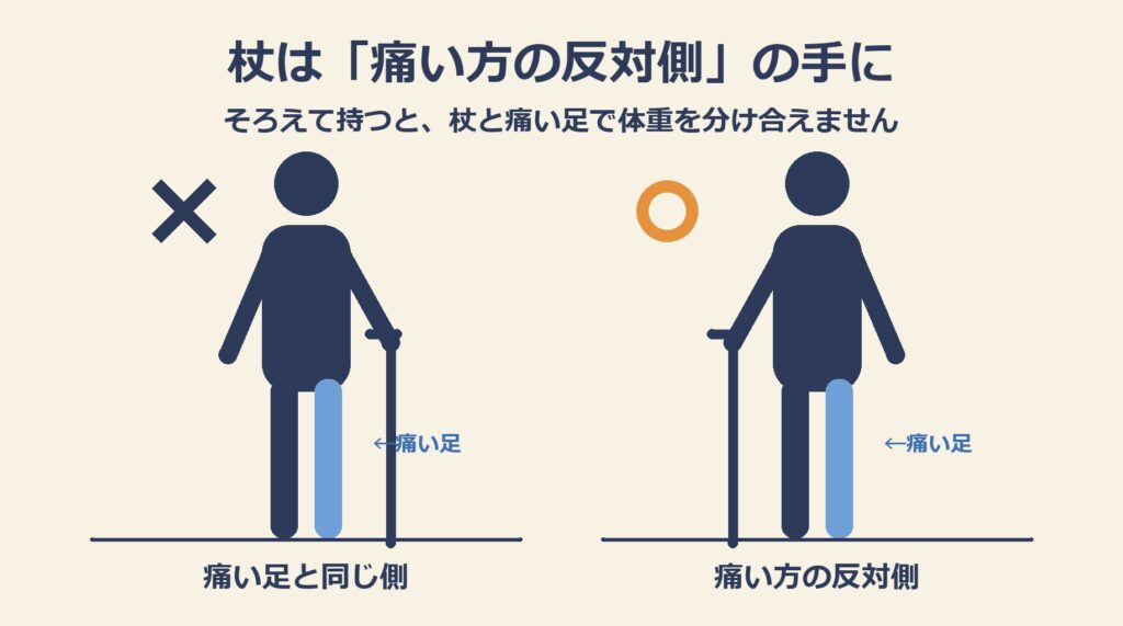 杖を持つ手の図解。痛い足と同じ側に持つと×、痛い方の反対側の手に持つと○。杖と痛い足で体重を分け合える